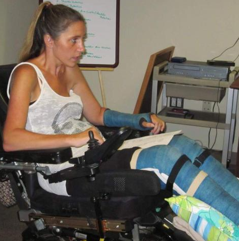 Various webfinds of women in orthopedic treatment - multiple or big casts, braces, wheelchairs, amputee