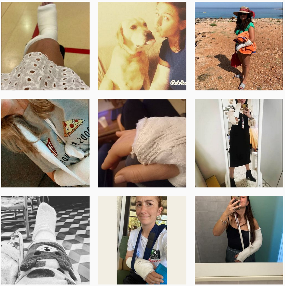 Pictures of italian women with arm or leg in various plastercasts