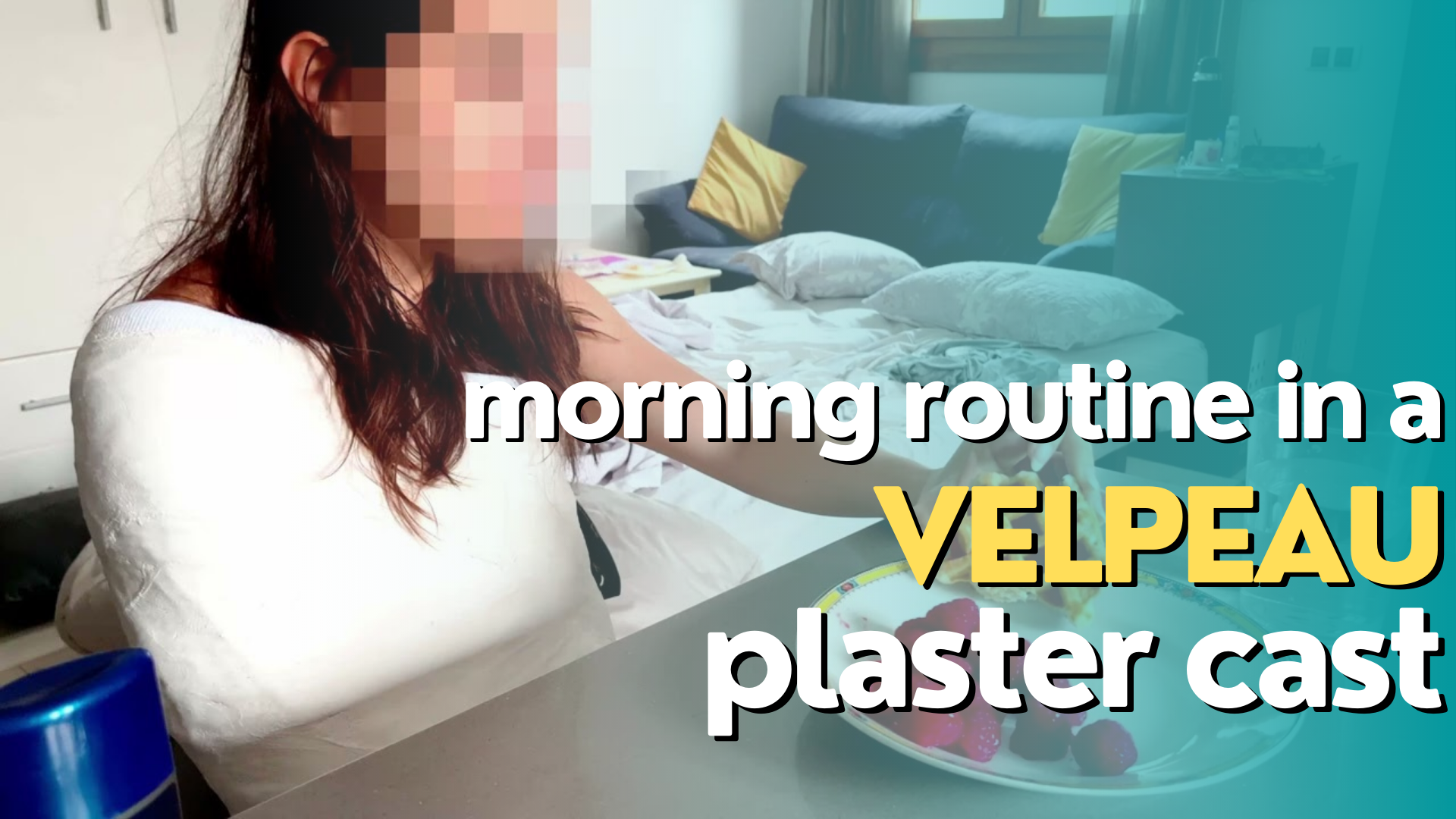 Watch me get up, have breakfast and clean around the house while I have my arm stuck to my body in a Velpeau cast. With a bit of perspective it was easier than the DSS but it was still a big challenge. I struggled a lot!   XOXO       Nora
