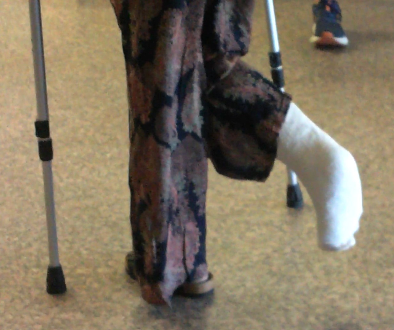 Italianlegcastcrutchingwheelchairsprain + Casts + Braces + Sprain