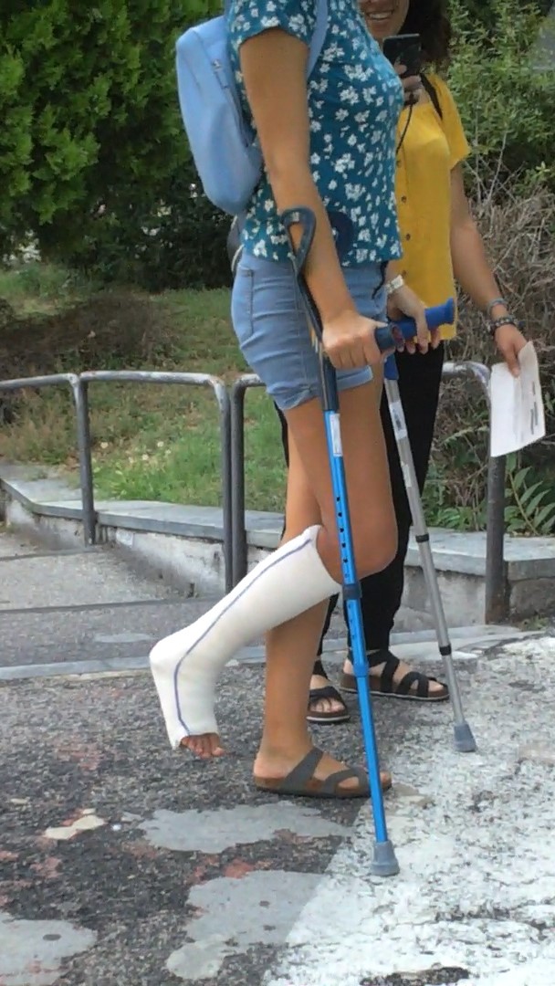 italian-legcast-crutching-wheelchair-sprain-casts-braces-sprain