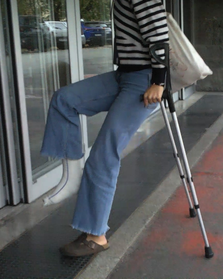 This beautiful girl broke her right ankle. She is wearing a white SLC, with her fingers exposed. She is very good on her crutches. Beautiful close-ups on his Slc. Lots of scenes, crutching, leg hanging on crutches, fingers moving, etc.... Vid 18:51
