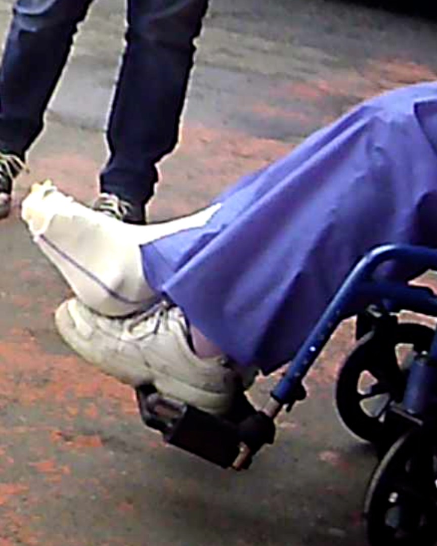 Italian-legcast-crutching-wheelchair-sprain