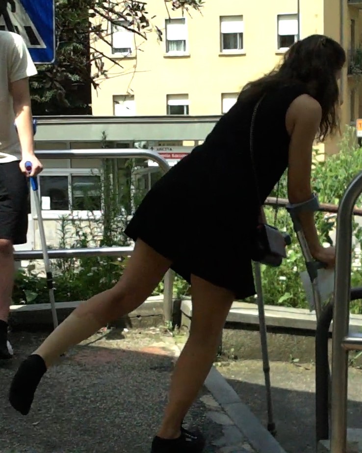 This gorgeous girl,  with a beautiful body,  twisted her left ankle.  She has her foot bandaged,  with only a black sock on it.  She moves easily on her crutches.  Vid 9:32