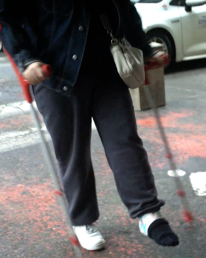 This girl broke her left ankle.  She wears a white Slc,  with a black sock over her fingers.  You can see decorations on her SLC.  She moves on her red crutches.  Vid 11:26
