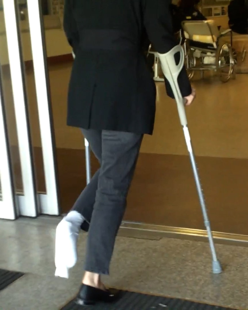 This beautiful lady has broken the toe of her left foot.  She has her foot completely covered by a white bandage.  Underneath, you can notice a splint.  She moves on her crutches.  Vid 6:46