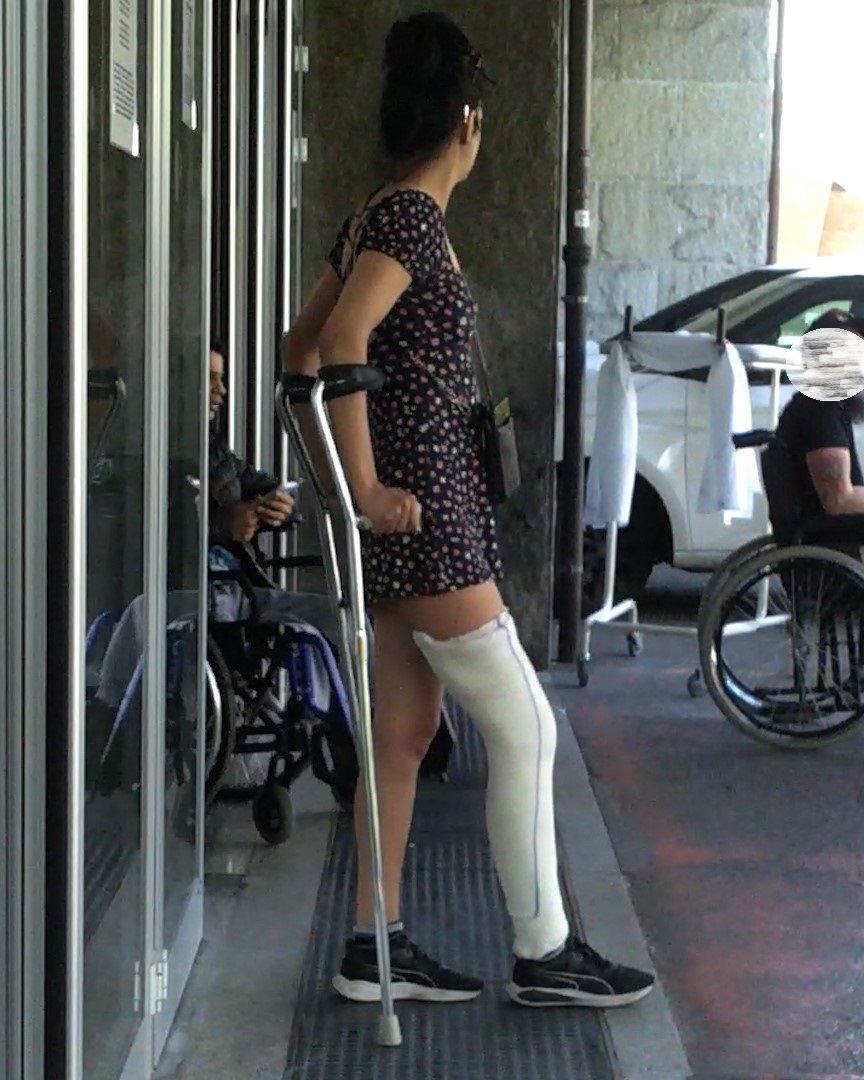 Italian-legcast-crutching-wheelchair-sprain