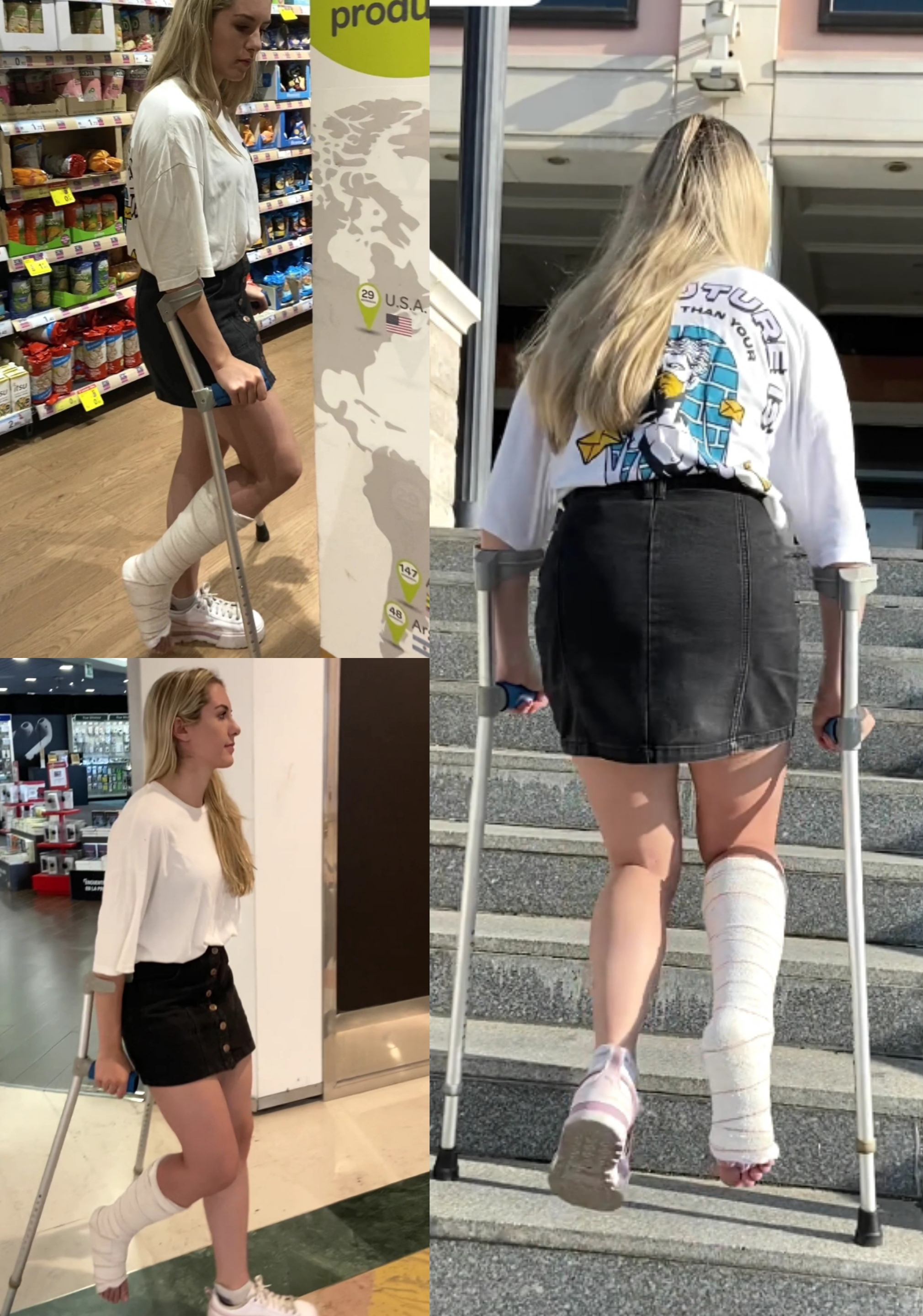 Real injury sprained ankle mall in Spain