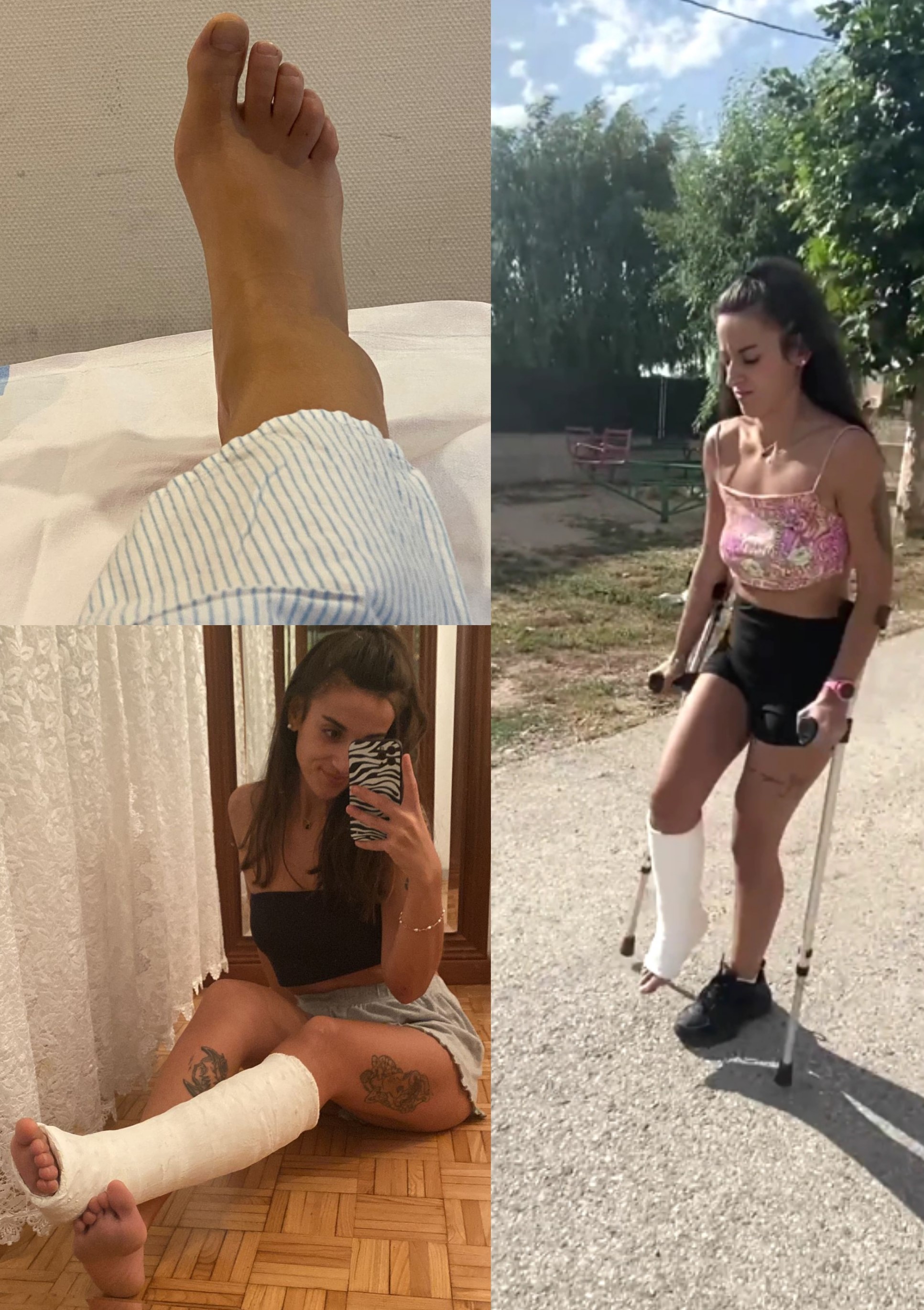 Real injury SLC crutching and interview