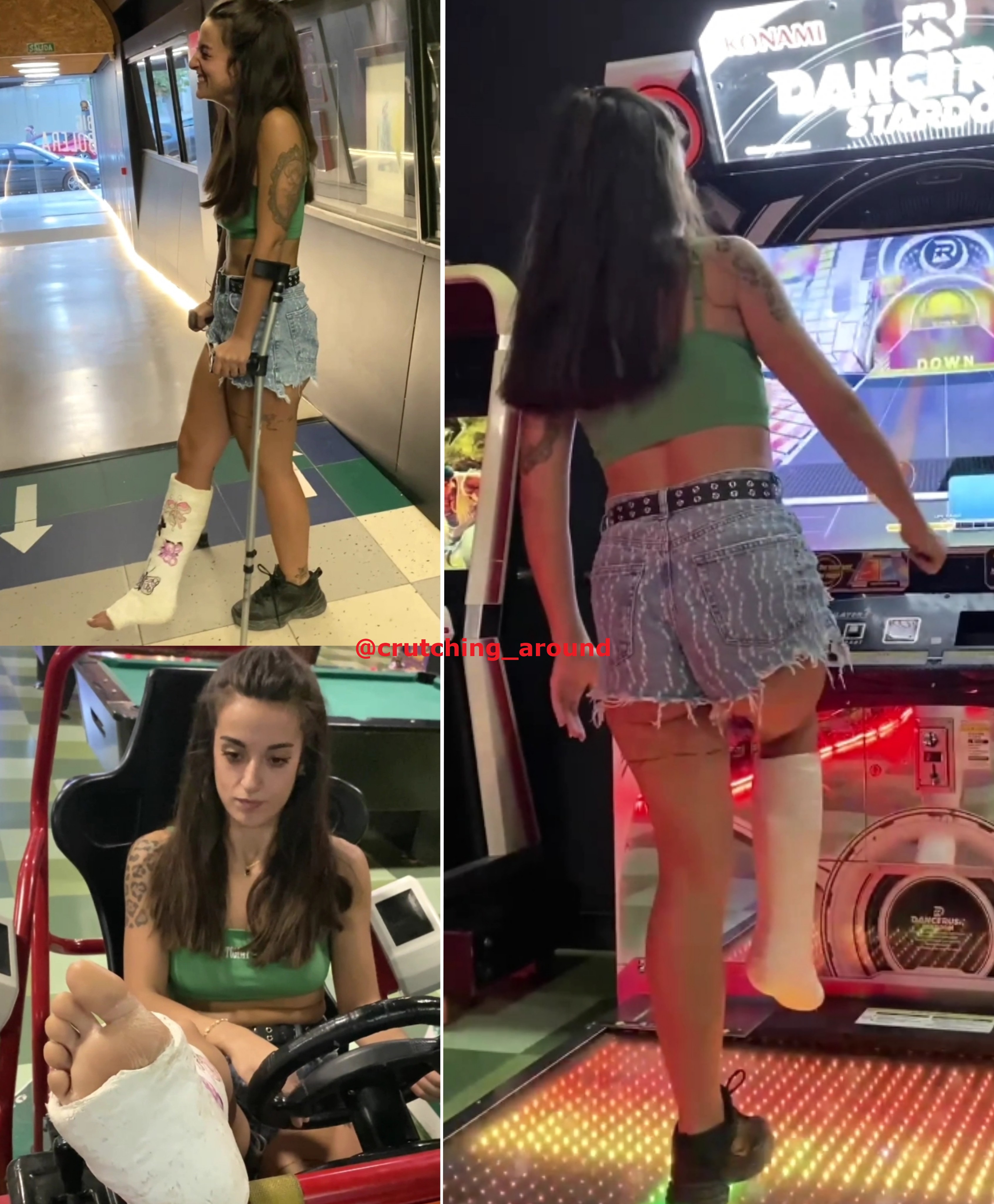 Real injury SLC arcade games hopping and crutching 