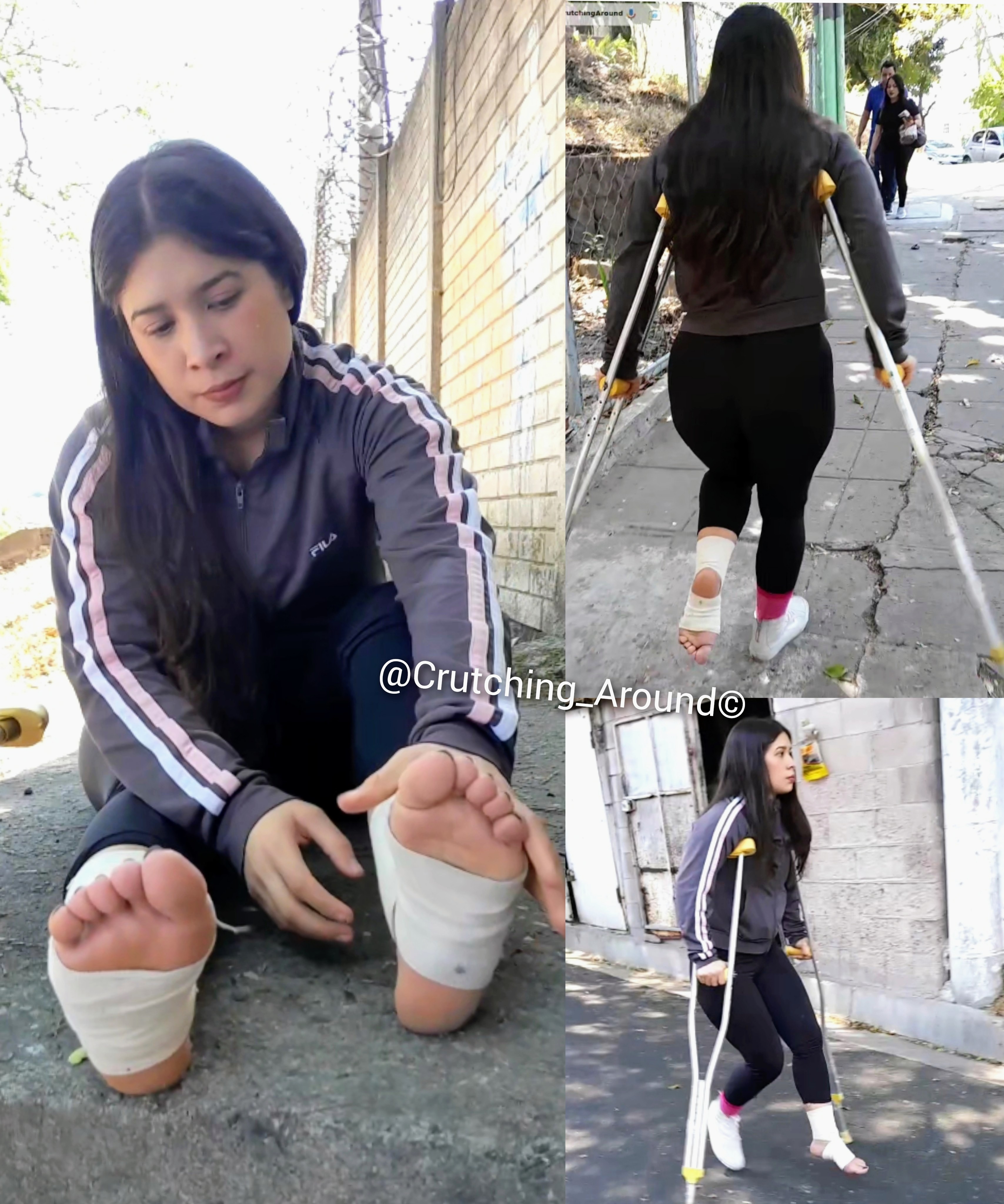 Short movie Double sprained ankle -Fabiola -