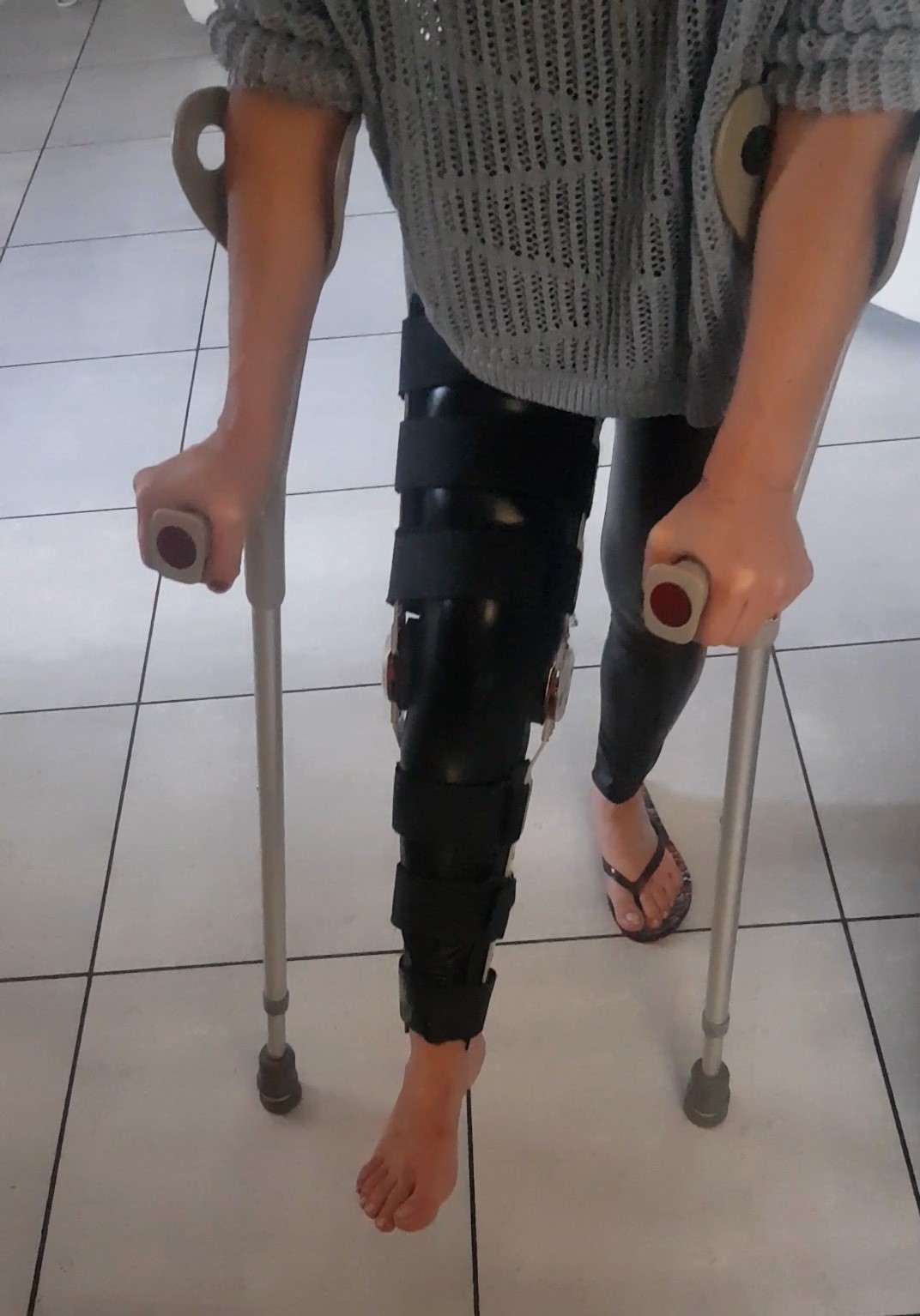 Driene twisted her right knee. She is wearing a kneebrace, and a pair of leather leggings. She walks on her crutches with only one flip-flop. For lovers of crutching, kneebrace and oneshoe. 4 minutes of video.