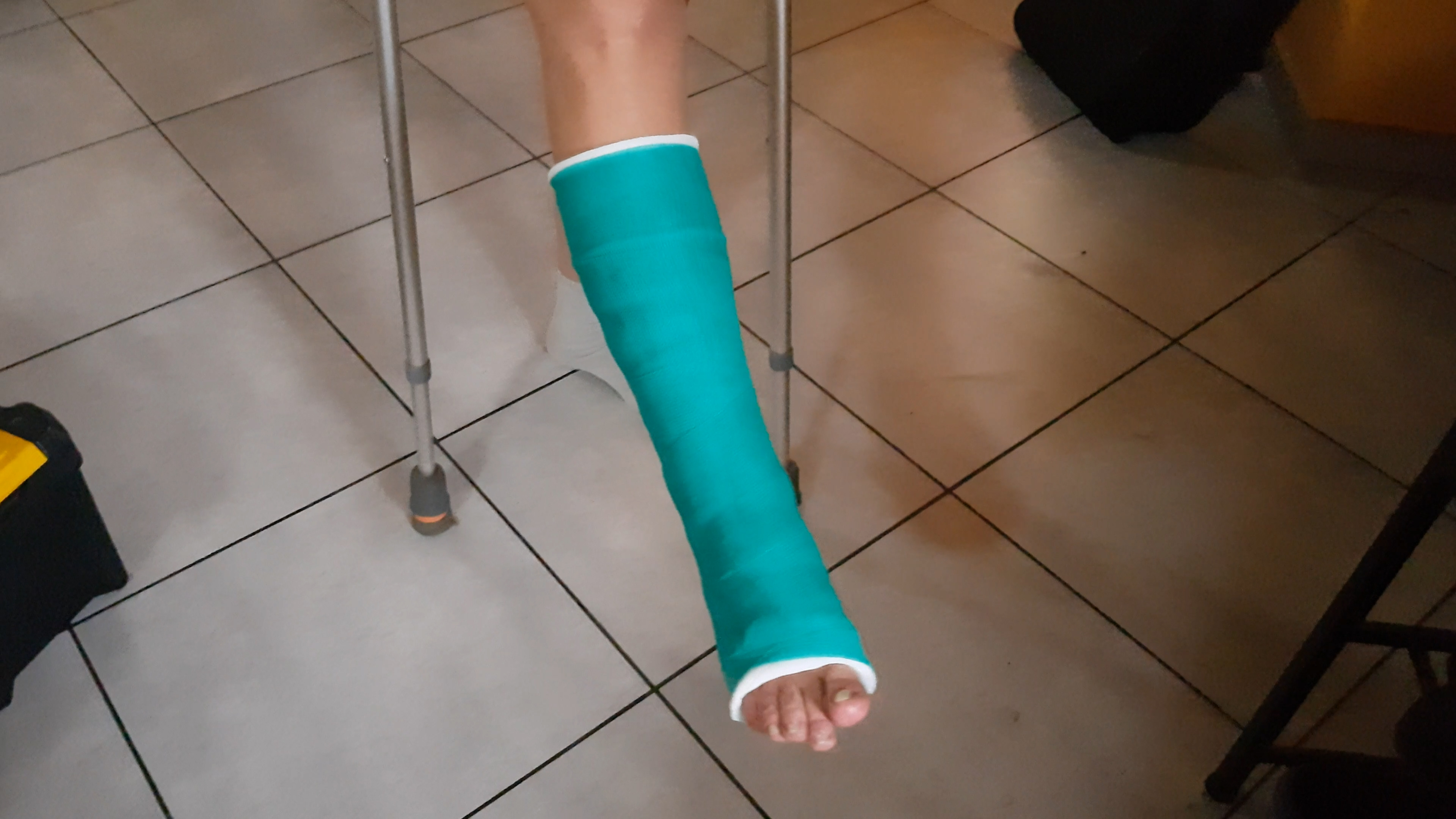 Drienne wears a fiber Slc for the first time.  The SLC is green in color, which she loves.  She moves on her crutches at home,  up and down the stairs, barefoot, and in a sock.  Beautiful close-ups on his green fiber Slc.  Vid 11:23