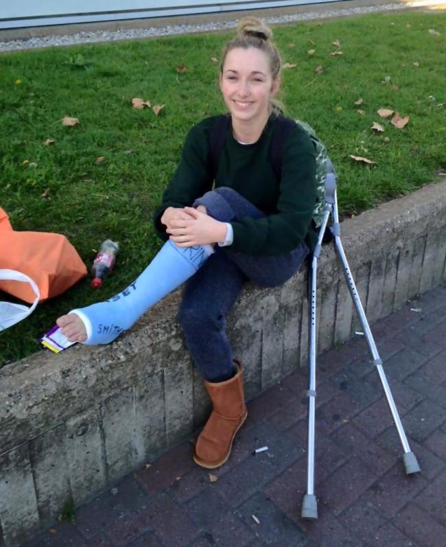 Her last ski race ended badly. Story & photos. ++ Photos with arm casts and leg casts.