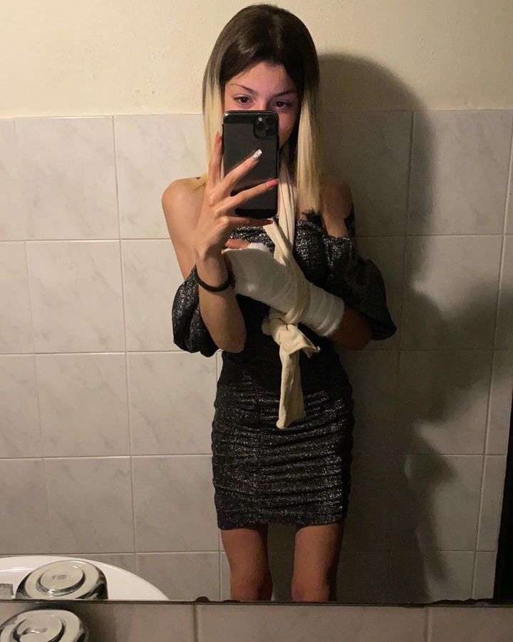 Bathroom selfies. ++ Photos with arm casts and leg casts.