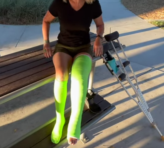 Skateboarding Fail and a New Lime Green Cast - Well, what's a gorgeous summer without a gorgeous LLC? Took a tumble and broke my leg while skating in the park and now spending the rest of these summer daze on crutches in a bright green cast.