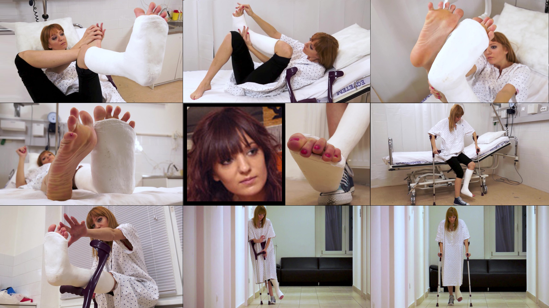 Casted Memories Clip: Hugi Term SLC Crutch Practicing at the Clinic