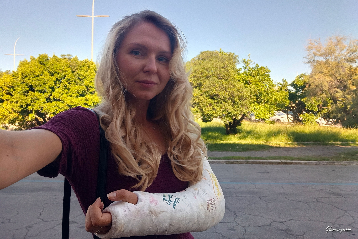 Svitlana LAC+MultiBrace - VIDEO 05: At the hairdresser's with my broken arm