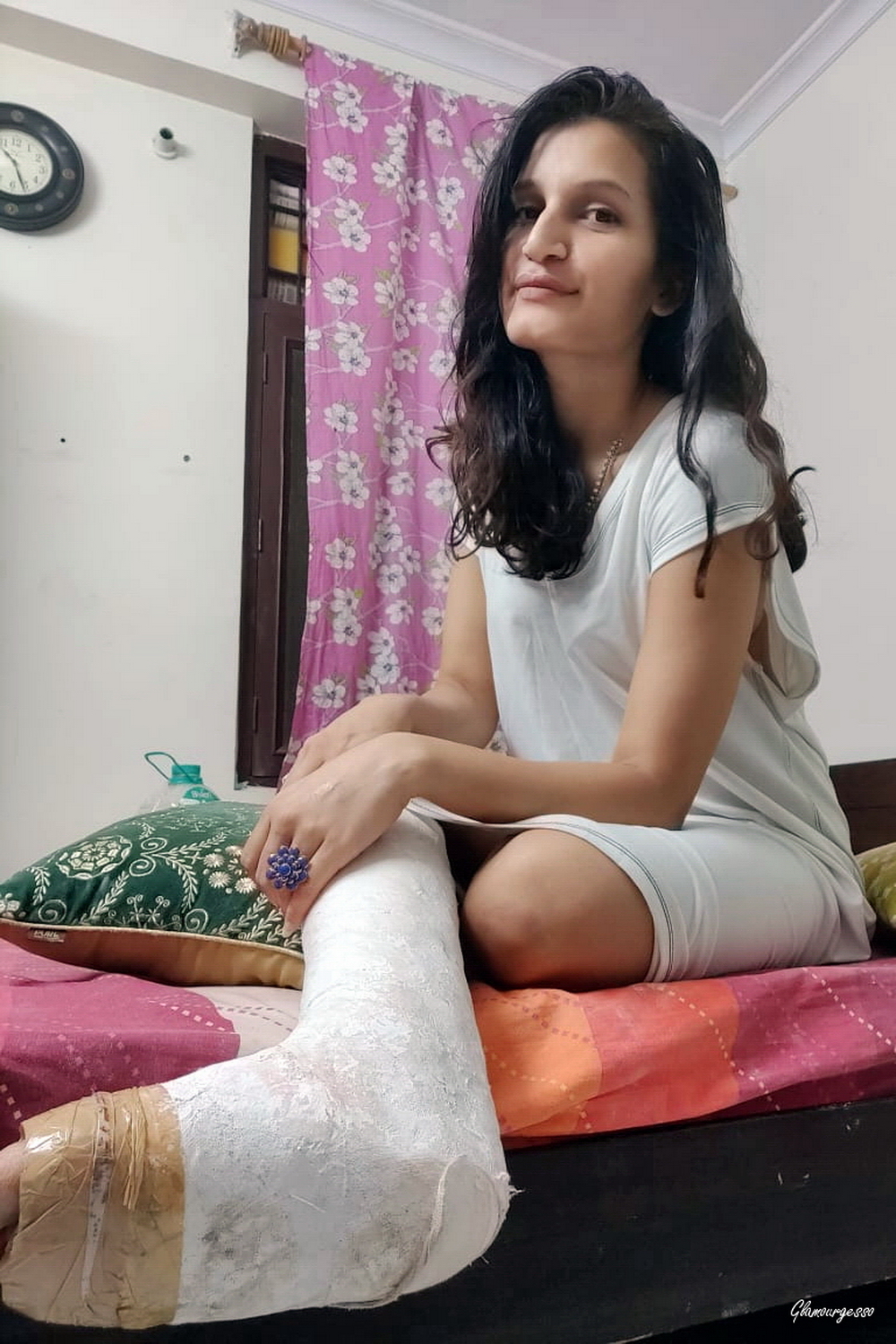 Sameera Medical SLC - PHOTOPACK: dian professional model Sameera wears her Medical Short Leg Cast showing you her 1 month long life on crutches after breaking her left ankle falling with her bike in Delhi in summer 2020.