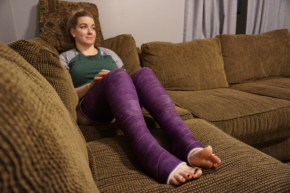 Jessica DLLC - a pair of violet cast legs with bent knees makes walking impossible for Jessica (Gallery Update)
