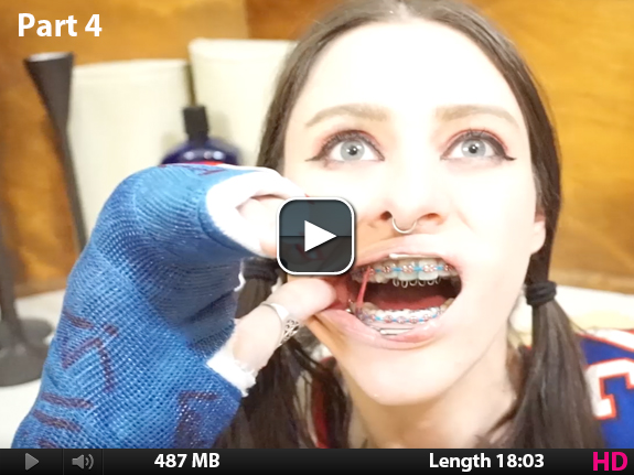 Amanda Quad Casts & Braces with Lip Guards Videos 3 and 4