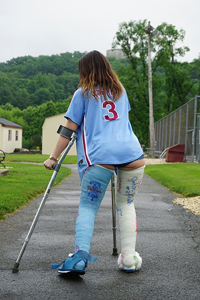 Victoria Double Leg Cast Update 