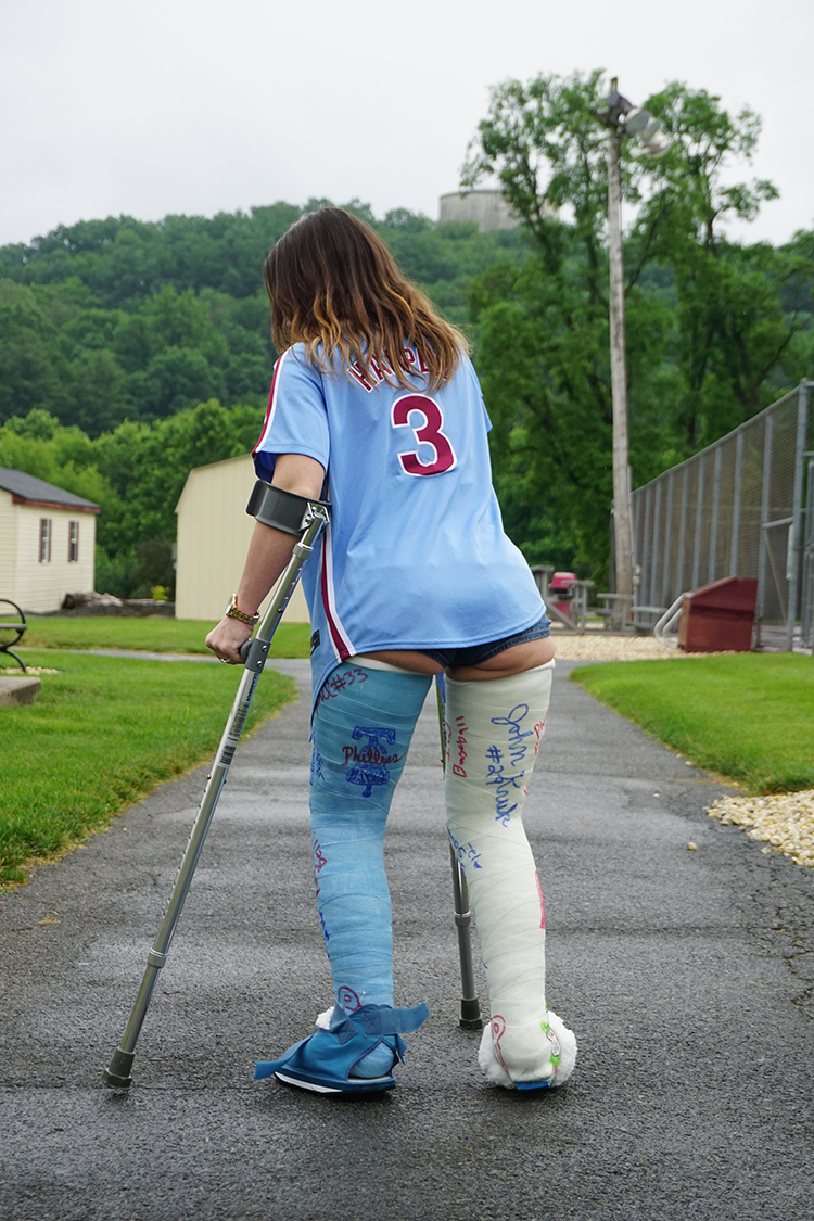 Victoria Double Leg Cast Gallery Update 