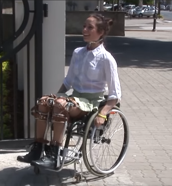 BracedLife Patreon Casts Braces Orthodontics Diaper Cnews