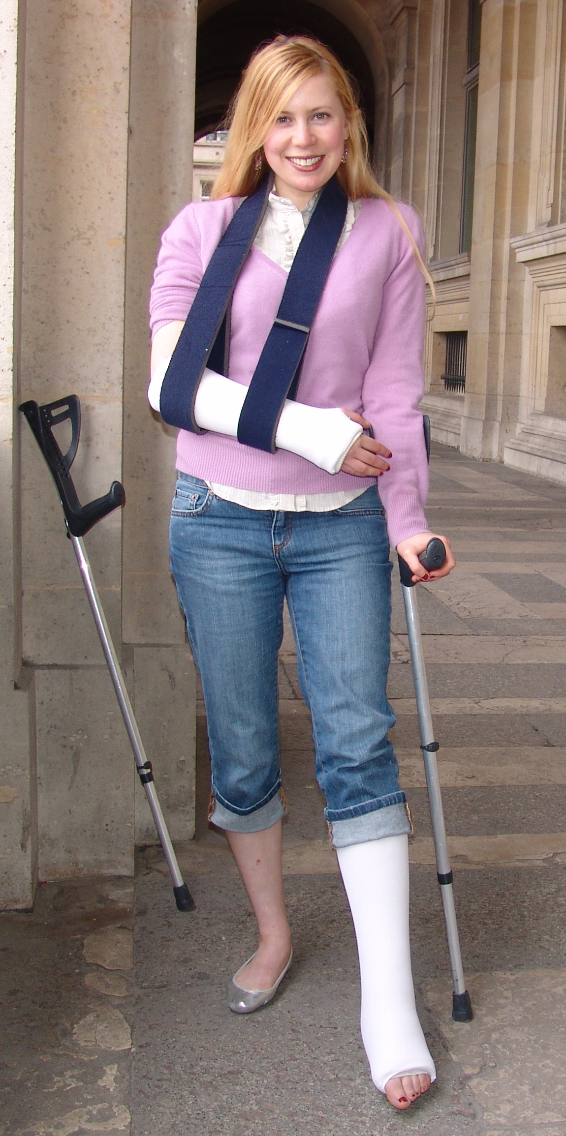 Pretty women with cast and crutches