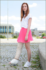 Misha wearing a thick, plaster longleg walking cast LLWC  (56 images in set)