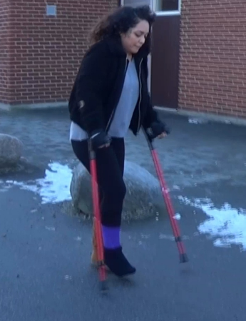 Alexie SLC #2 -   Alexie is on crutches with a SLC on her right foot and is today crutching in the Swedish winter with a sock over her cast: Since there can be ice on the road she crutch gently forward so that she does not slip and injure herself...