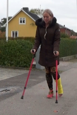 Rose SLC #85 - Rose really looks to enjoy jumping around on her crutches with a yellow short leg cast on her left leg and she absolutely does not mind showing it to us.  Because Rose has injured her achilles tendon is her cast pointed so even...