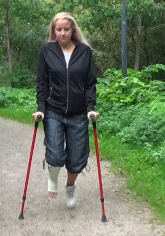 Crutchcast Clips + Casts + Braces + Sprain + Crutches + Bandage | cnews