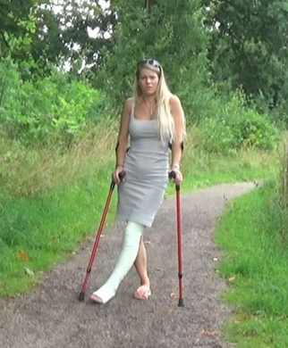 Crutchcast Clips + Casts + Braces + Sprain + Crutches + Bandage | cnews