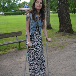 Ranna SLC 1-1 short leg cast and crutches