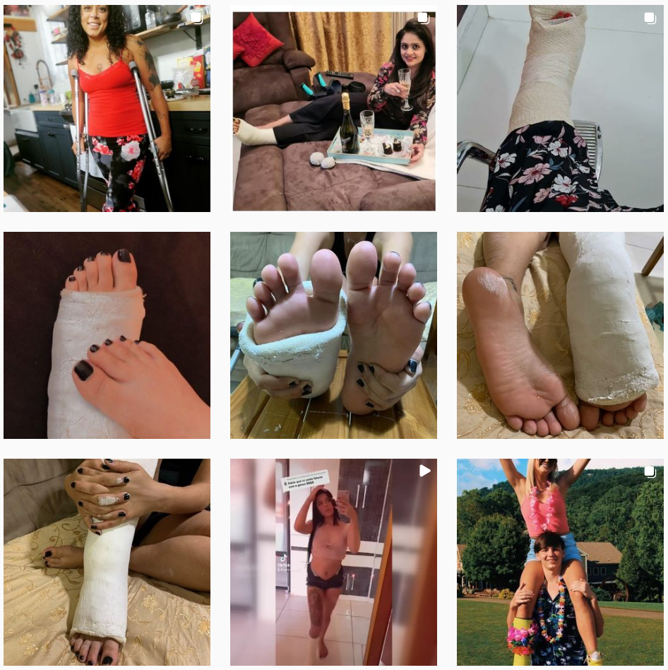 New finds showing beauties in orthopedic casts...