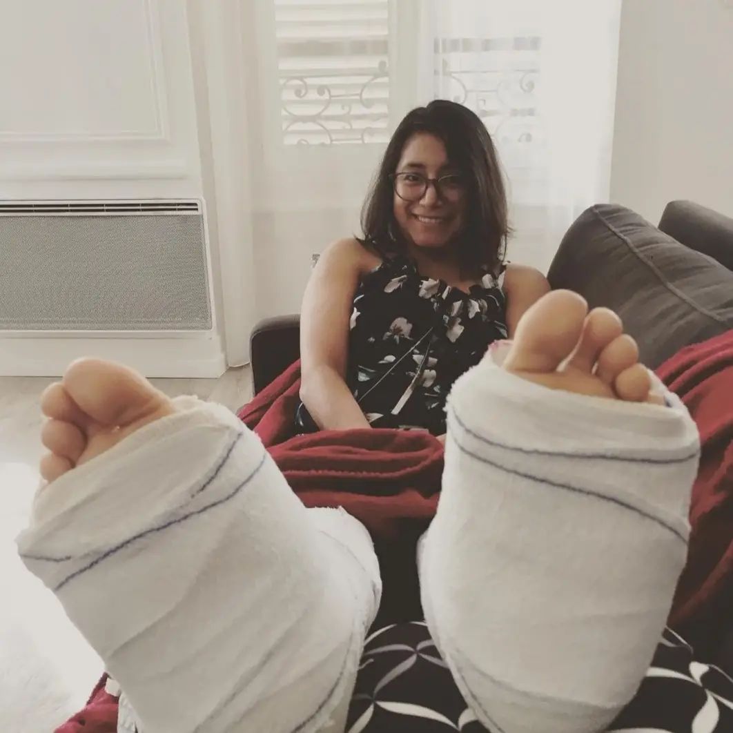 Carla broke both legs - now in dual legcasts + other webfinds