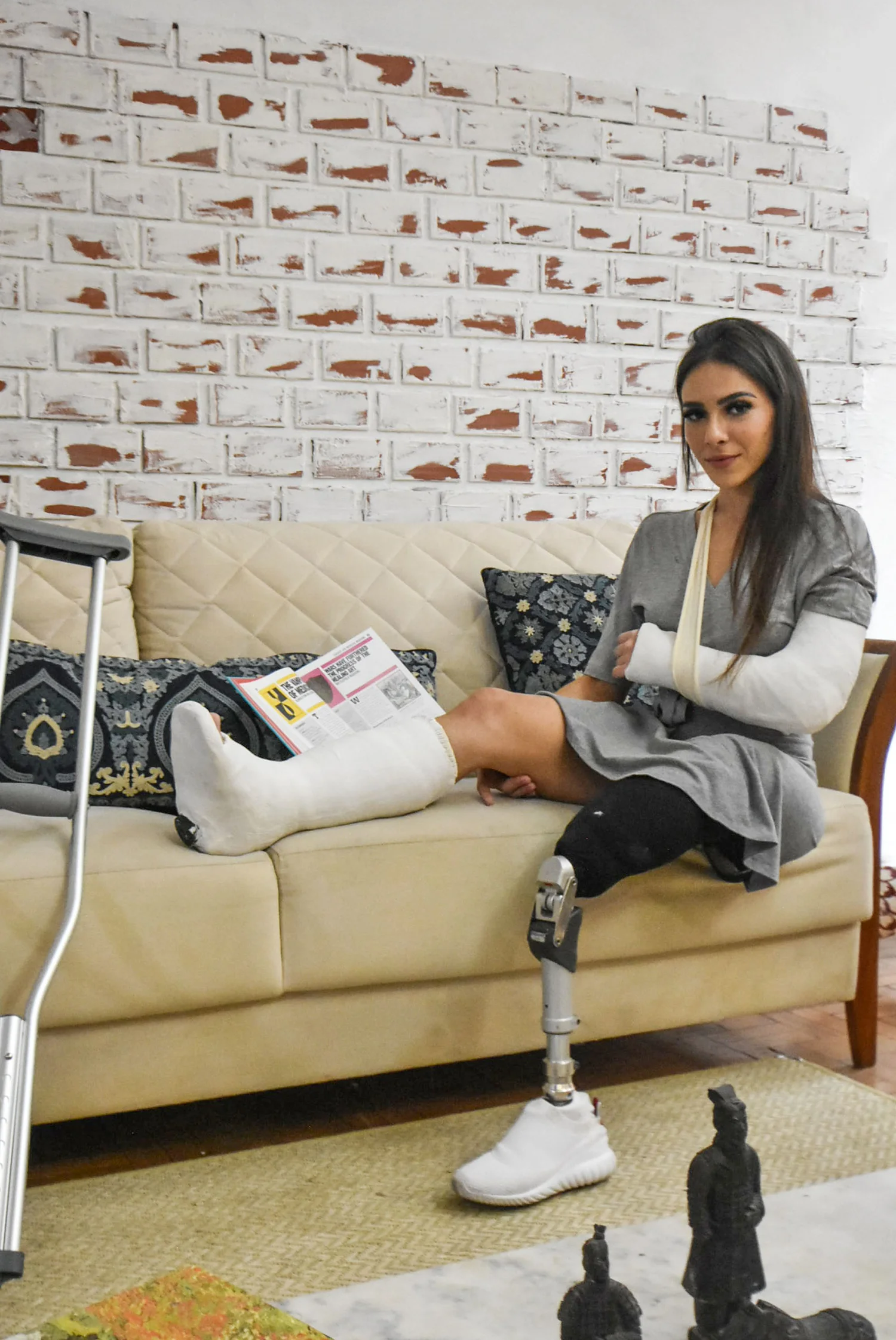 Giovanna SAK + SLWC + LAC - Chapter 01 - A amputee suffers a terrible run over and suffers multiple fractures + Accident the hit-and-run + Plastering Leg + Fresh Plaster Casts