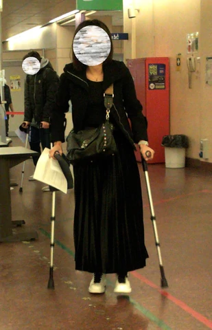 This beautiful woman broke her left knee. Since she cannot walk on her injured leg, she uses crutches. 