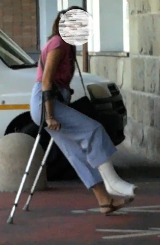 Girl white SLC - on crutches and in wheelchair (32) ++ Girl crutching - white SLC covered with black sock (31)