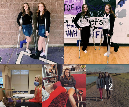 females in arm casts & different leg casts