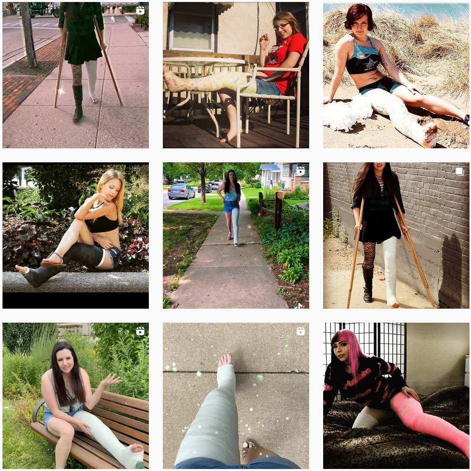 Appreciating the unique beauty of pretty gals wearing a cast - the ultimate 